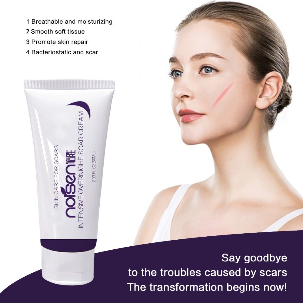 Private Label Organic Deep Scar Removing Treatment Repair Anti Pimples Marks Stretch Cream Acne Stretch Marks Scar Removal Cream