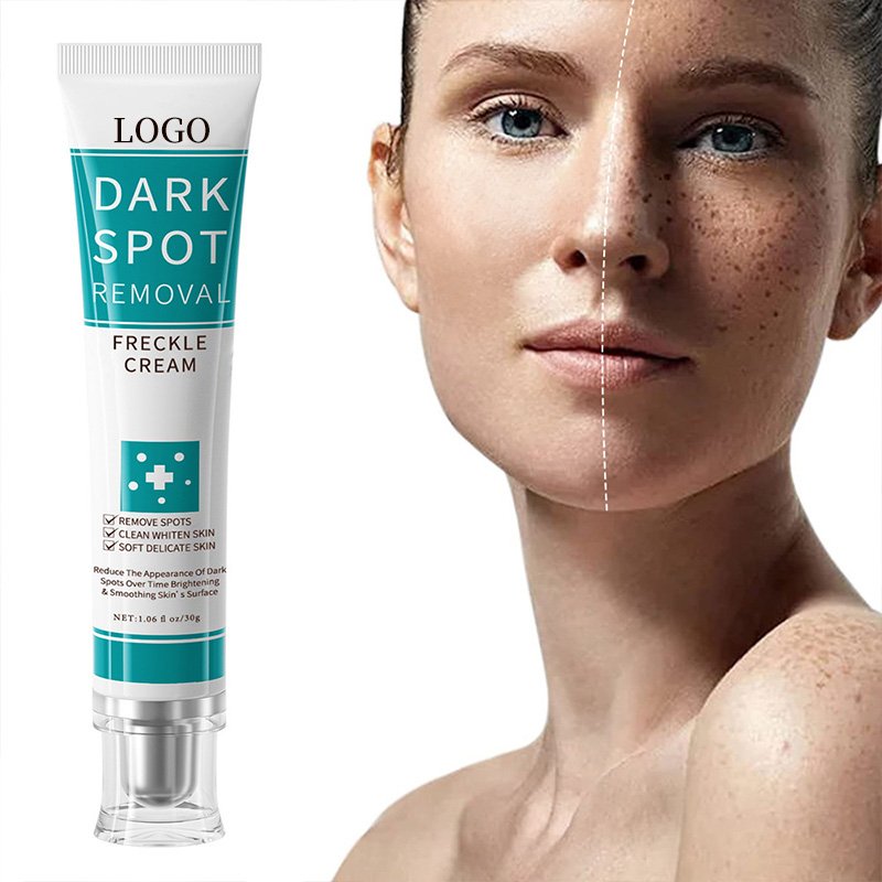 Private Label Strong Effective Whitening Freckle Cream Removal Melasma Dark Spot Melanin Remover Brighten Skin Face Cream