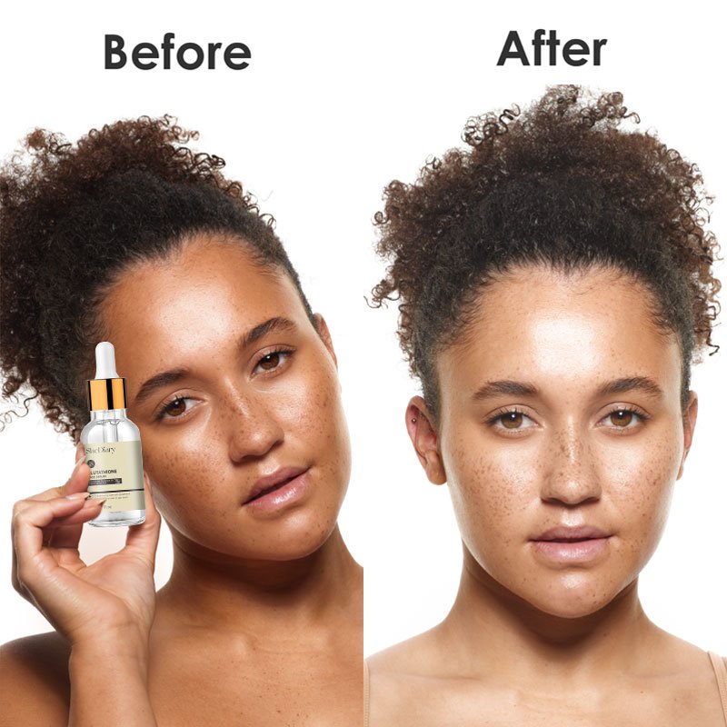 Private Label Glutathione Whitening Freckle Serum Remove Melasma Dark Spots Face Whitening Serum with Vitamin C Kojic Acid