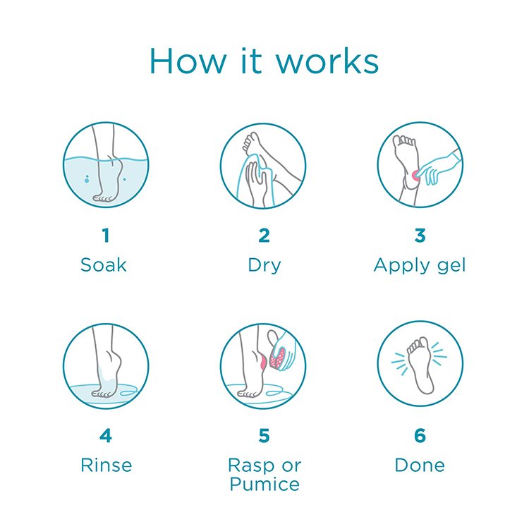 New Arrival Best Exfoliater Eliminating Rough Foot Heel Callus Remove Foot Exfoliating Gel