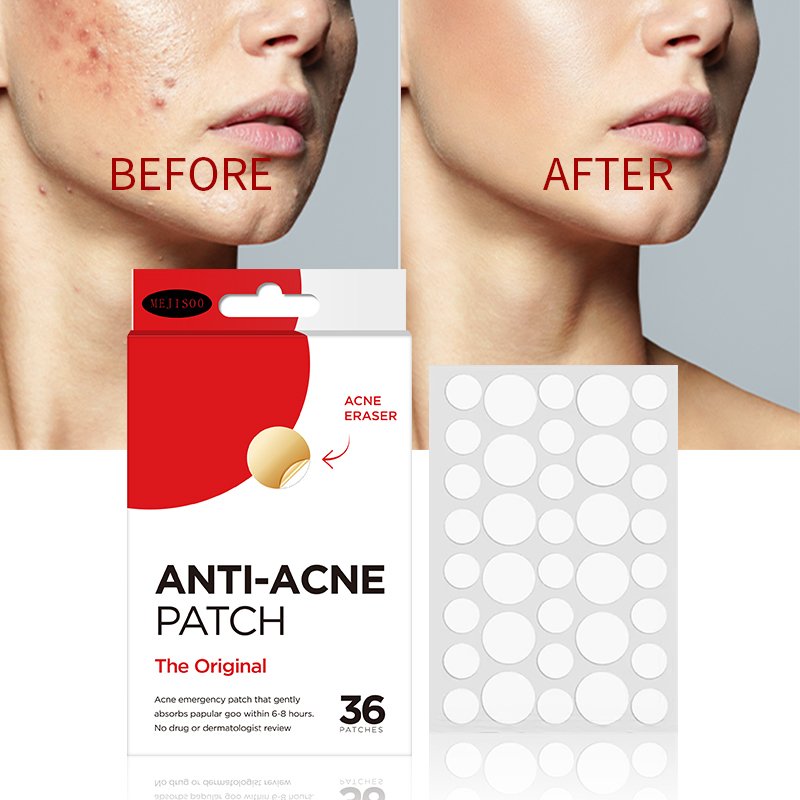 Manufactory price mighty hydrocolloid anti acne pimple patch best selling products for face