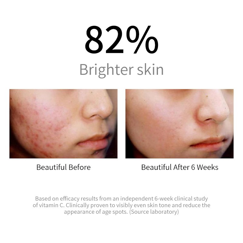 Custom Brightening And Hydrating Facial Renewing Cream Anti-Aging Overnight Facial Moisturizer Vitamin C Intense Night Cream