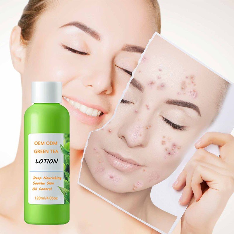 OEM ODM Skin Care Deep Moisturizing Nourishing Oil Control Soothing Natural 120ml Green Tea Lotion for Face Body