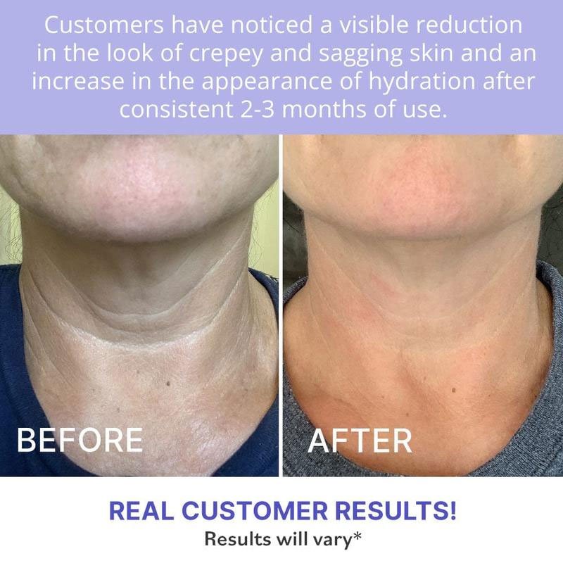 tiktok hot sale product Hyaluronic acid caffeine tighten Lift Neck Cream anti aging whitening Night Day Firming balm