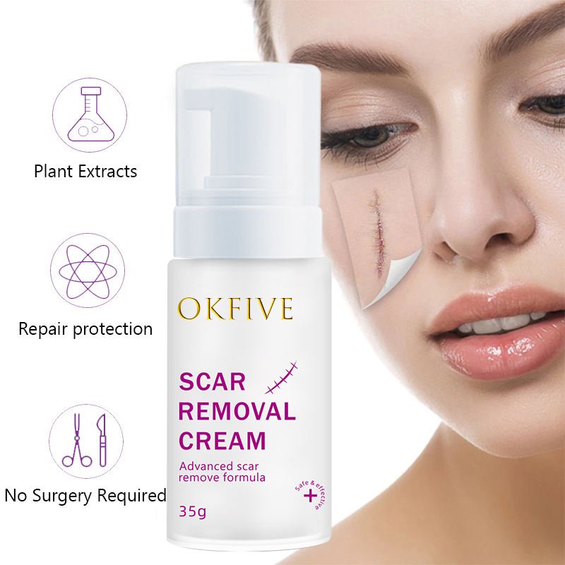 Self Owned Brand Waterproof And Quick Scar Repair Painless Removal Cream Strong Acne And Scar Removal Cream