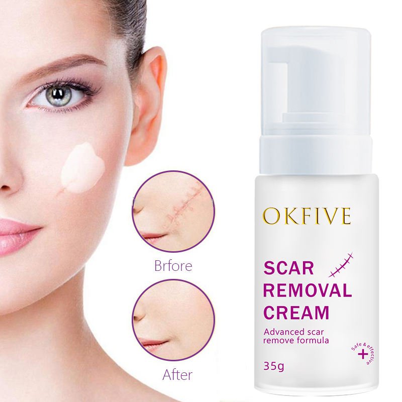 Self Owned Brand Waterproof And Quick Scar Repair Painless Removal Cream Strong Acne And Scar Removal Cream