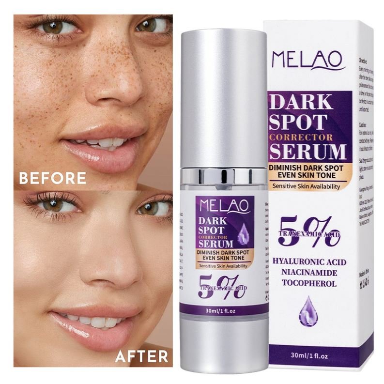 High Quality Skin Whitening Discoloration Fading Complex with Niacinamide Glowing Skin Facial Dark Spot Removal Serum