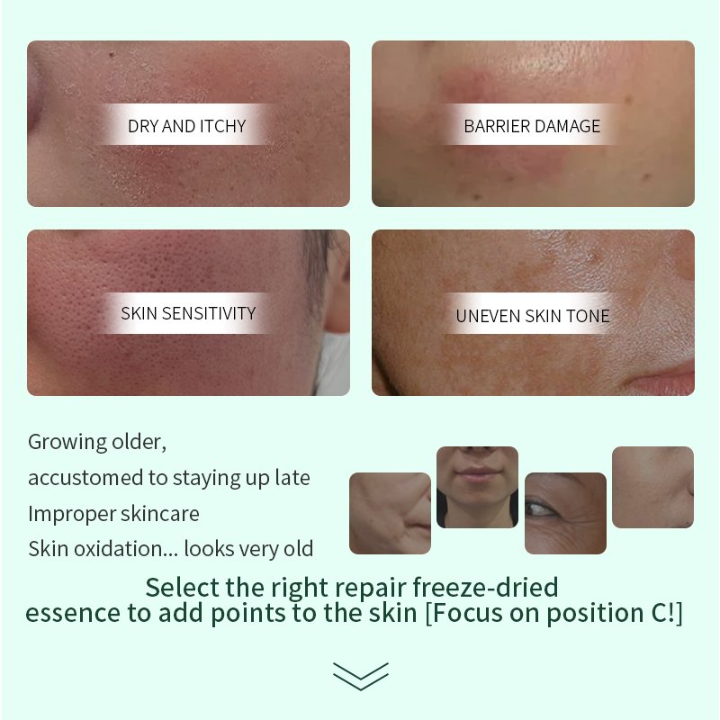 factory wholesale Whitening antioxidant anti-wrinkle skin hydration peptide factor freeze-dried powder serum set private label