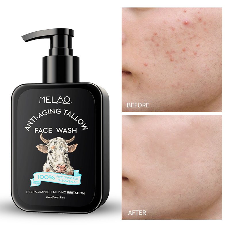 OEM Organic Skin Care Anti-aging Tallow Face Wash Helps Reduce Wrinkles, Sun Spots And Discoloration Tallow Face Wash Cleanser