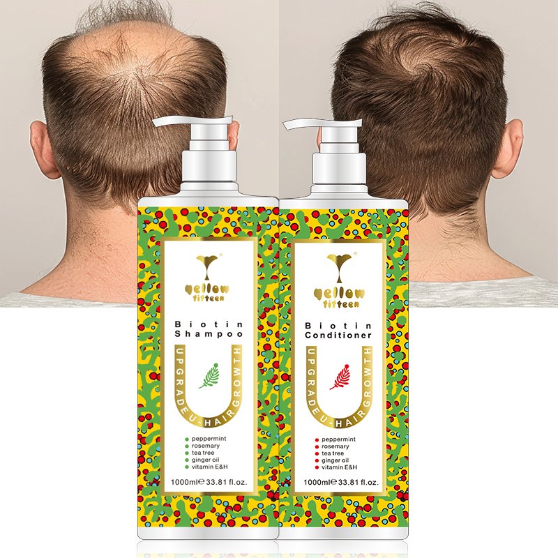 OEM hair growth set rosemary custom tea tree oil shampoo and conditioner ginger hair growth oil