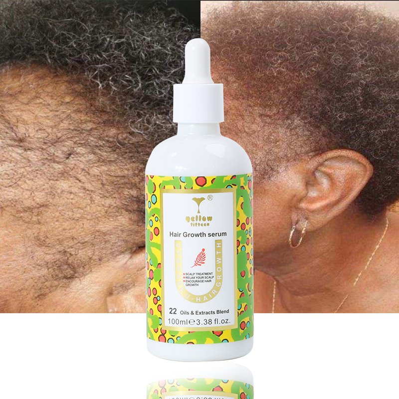 Rosemary peppermint tea tree oil and ginger oil biotin hair growth shampoo hair care set