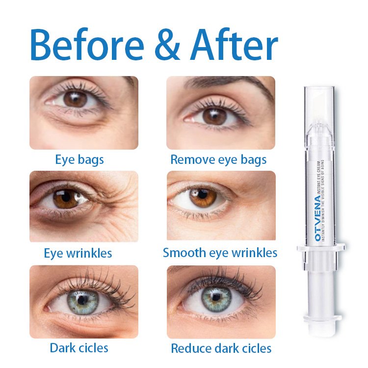 Hot selling high quality emollient anti-dark circles quick wrinkle removal eye bag removal cream