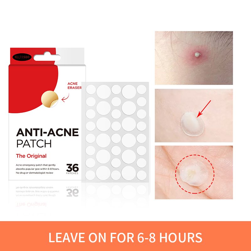 Wholesale price mighty hydrocolloid anti acne Spot Acne Pimple Patches From Cosmetics