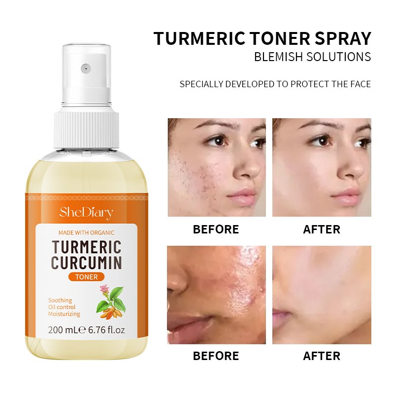 SheDiary Turmeric Toner Dark Spots Eraser Brightening Skin Even Skin Tone Fades Blemishes Acne Remove Whitening Face Toner