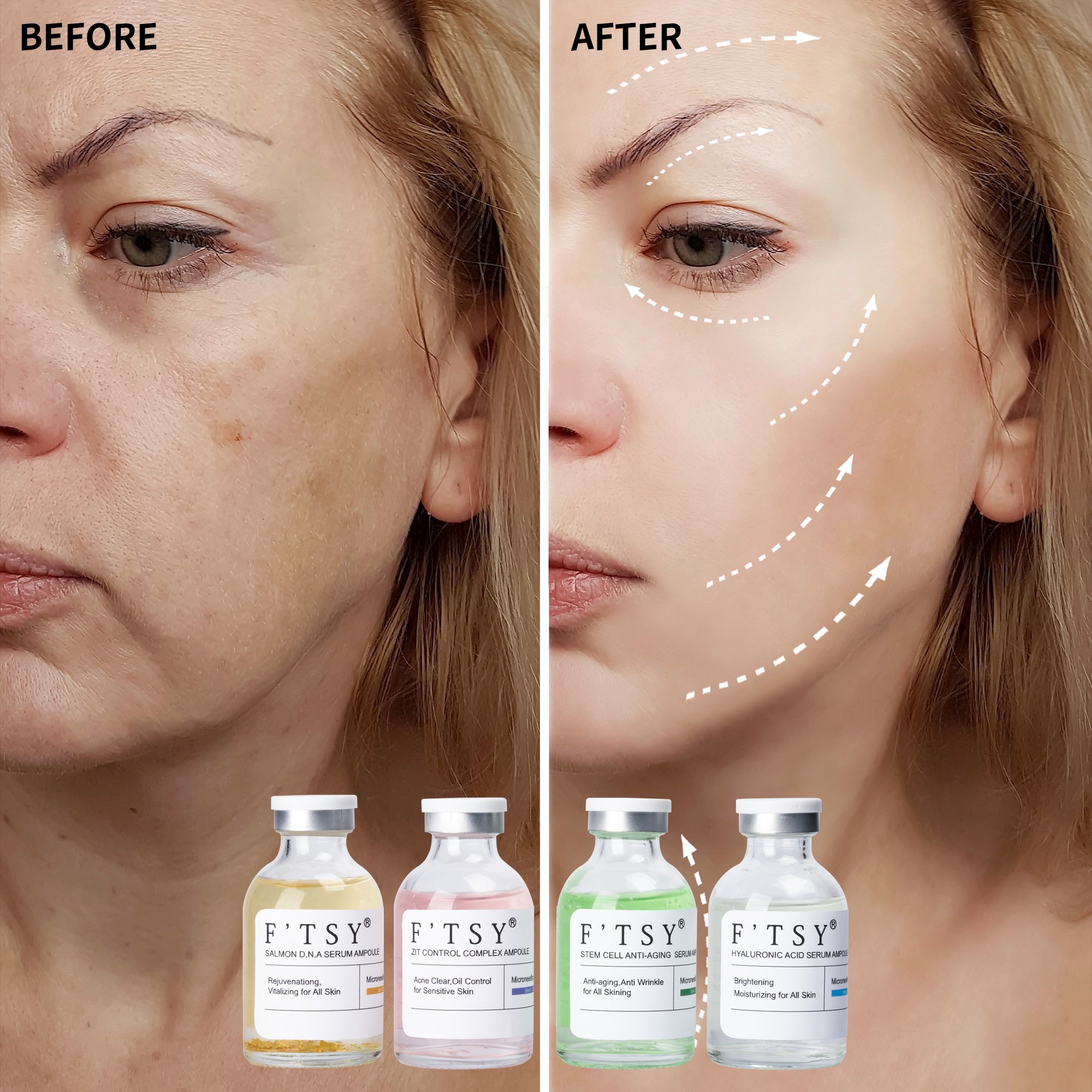 Private Label Facial Micro Needling Serum Set Vitamin C Collagen Ampoules Microneedling Serum