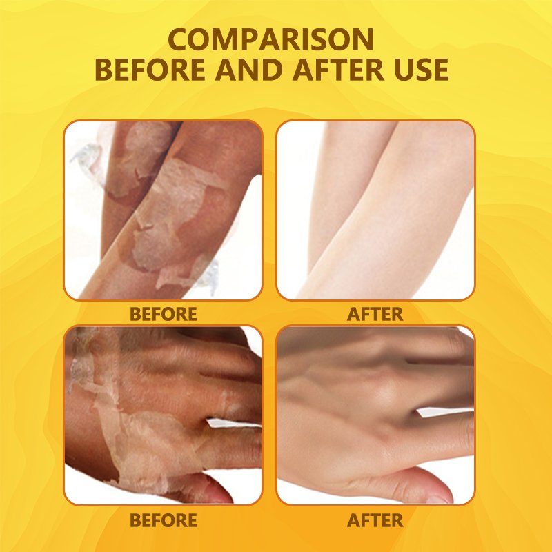 SheDiary Yellow Peeling Oil Vitamin C Knuckle Whitening Moisturizing Dark Spot Removal Extra Strength Peeling Oil
