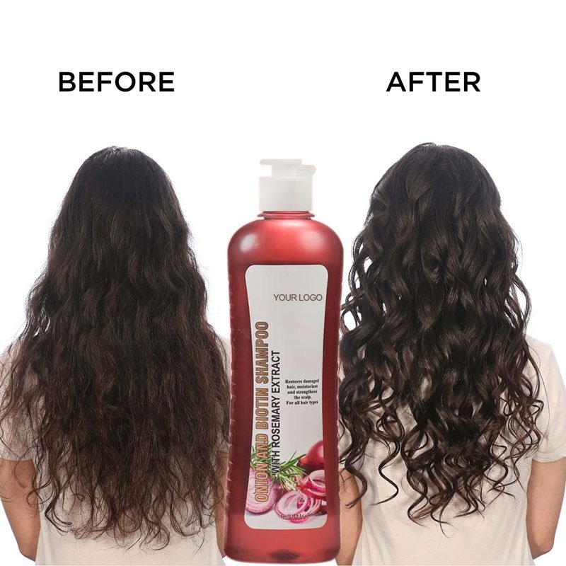 Biotin Rosemary Onion Shampoo Conditioner Tiktok Products Treatment Set For Hair Loss Silicone Free Anti Itch Reduce Hair Loss