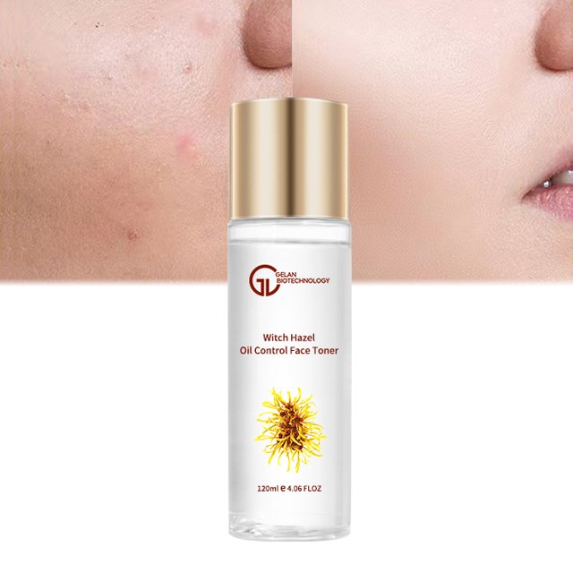 Wholesale Green Tea Anti-acne Witch Hazel Hamamelis Extract Moisturizing Face Toner Oil Control Facial Toner For Skincare