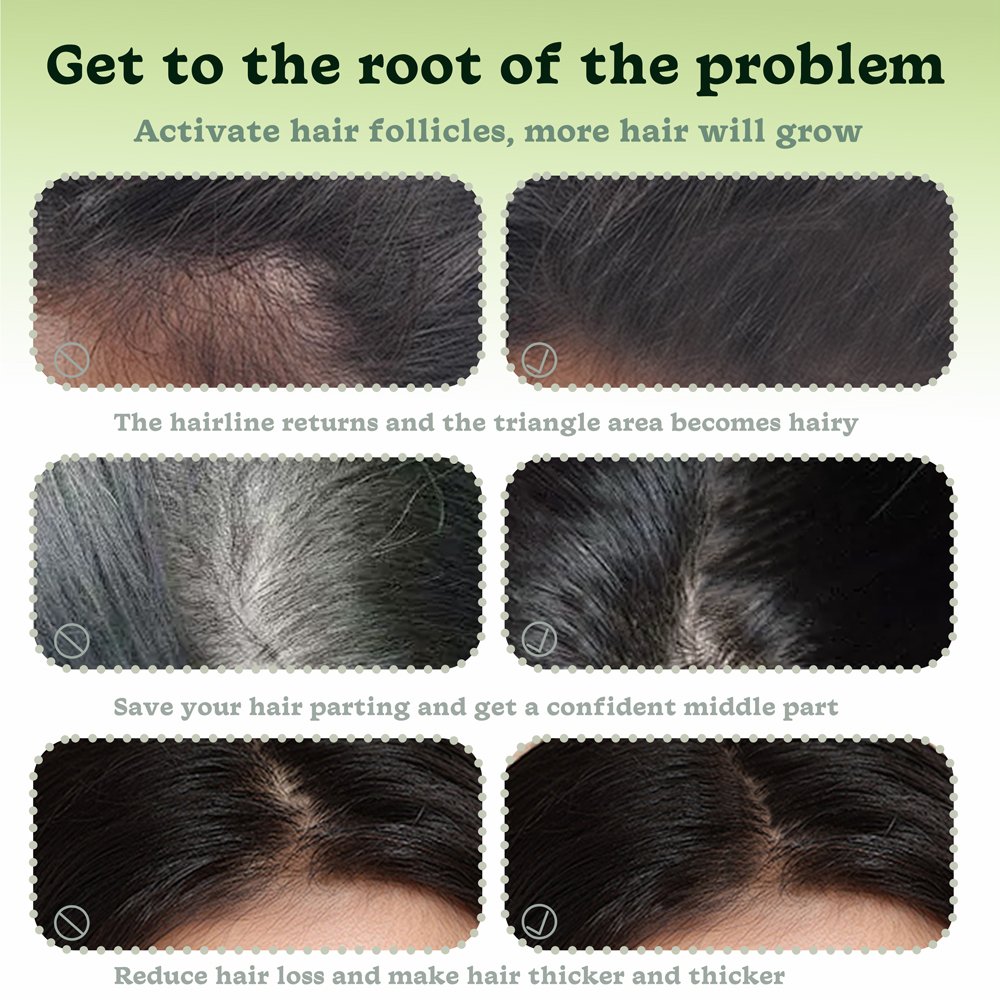 Wholesale Bulk Price Cold Pressed Jamaican Black Castor Oil for Hair Eyelash Growth 100% Pure Natural Organic Castor Oil