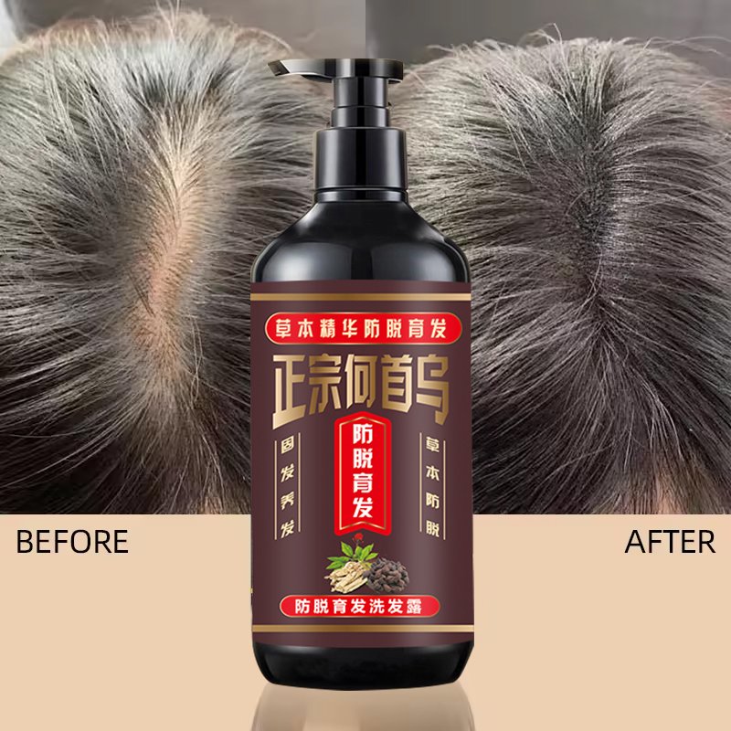 SKIH Factory Price Nourish Pure shampoo Anti-hair Loss polygonum multiflorum and angelica root Hair Care