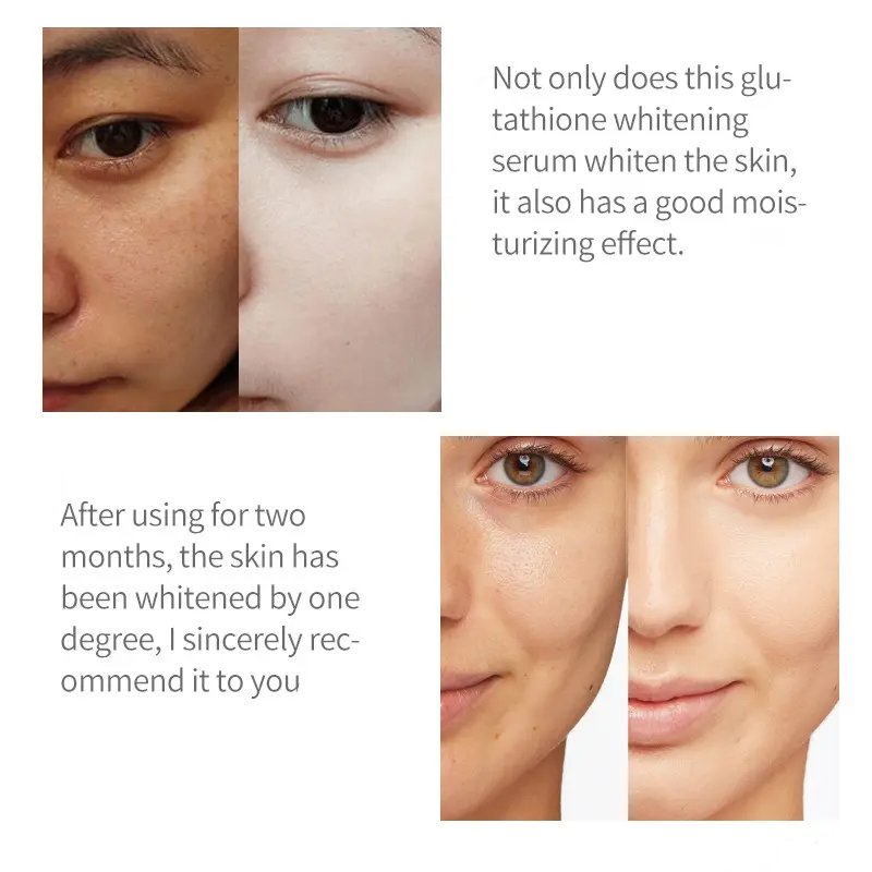 OEM SheDiary Hylonic Glutathione And Vitamin C For Face Serum Skin Whitening Repair Black Spot Glutathione Serum