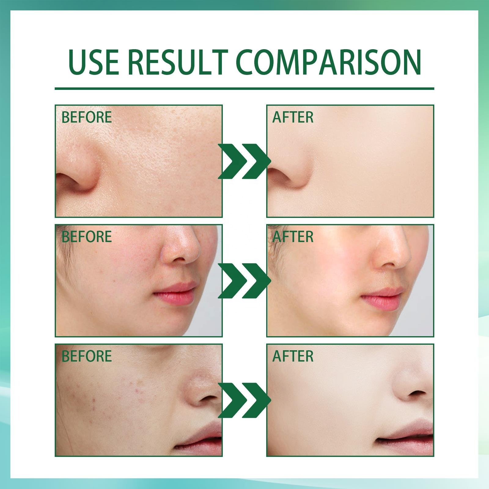 Jaysuing Hot Selling Wholesale Repair Soothe Moisturizing Shrink Pores Skin Rejuvenation Natural Organic Vitamin B5 Serum