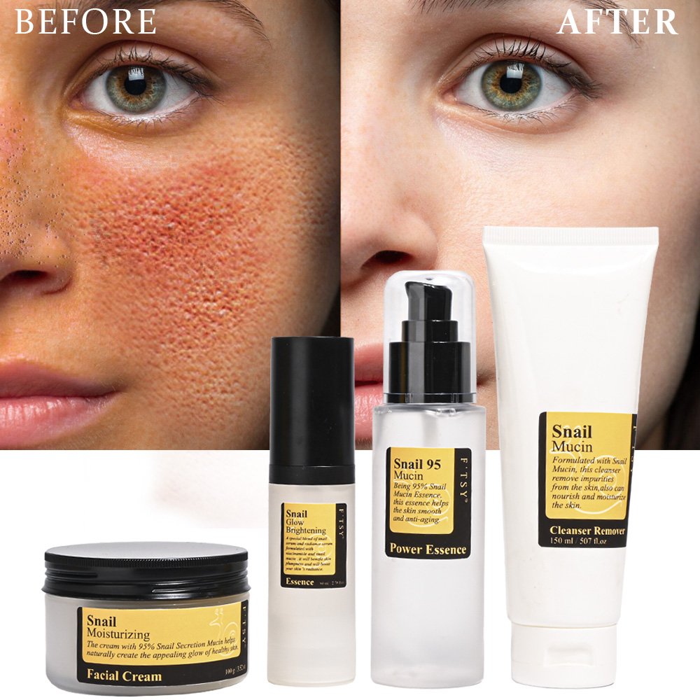 Organic Snail Serum Snail Cream Niacinamide Whitening Skin Care Set Brightening Snail Mucin Skin Care Set