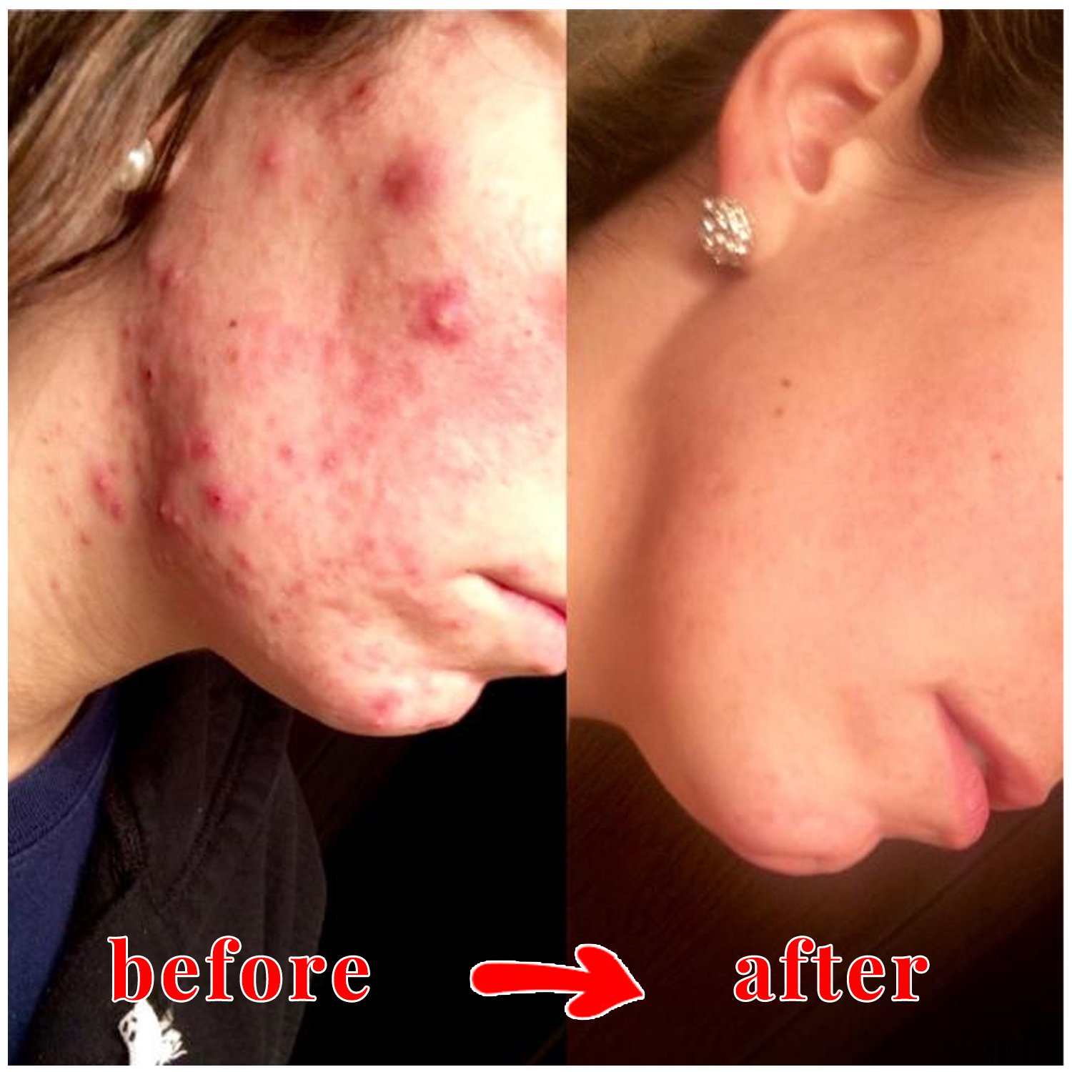 Kojic Acid Soap Clean Body Face Brightening Pigmentation Dark Spots Skin Lightening Kojic Acid Soap 65g
