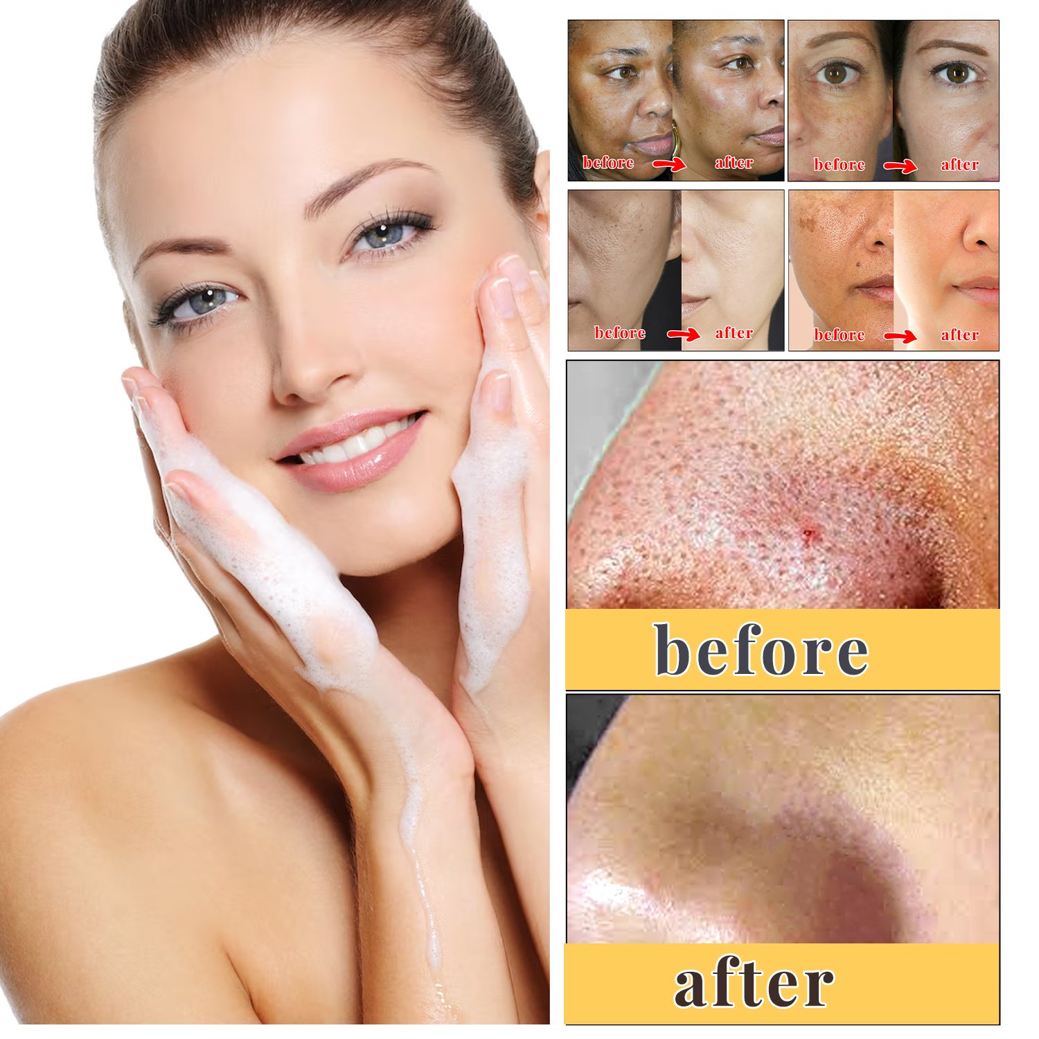 Kojic Acid Soap Clean Body Face Brightening Pigmentation Dark Spots Skin Lightening Kojic Acid Soap 65g