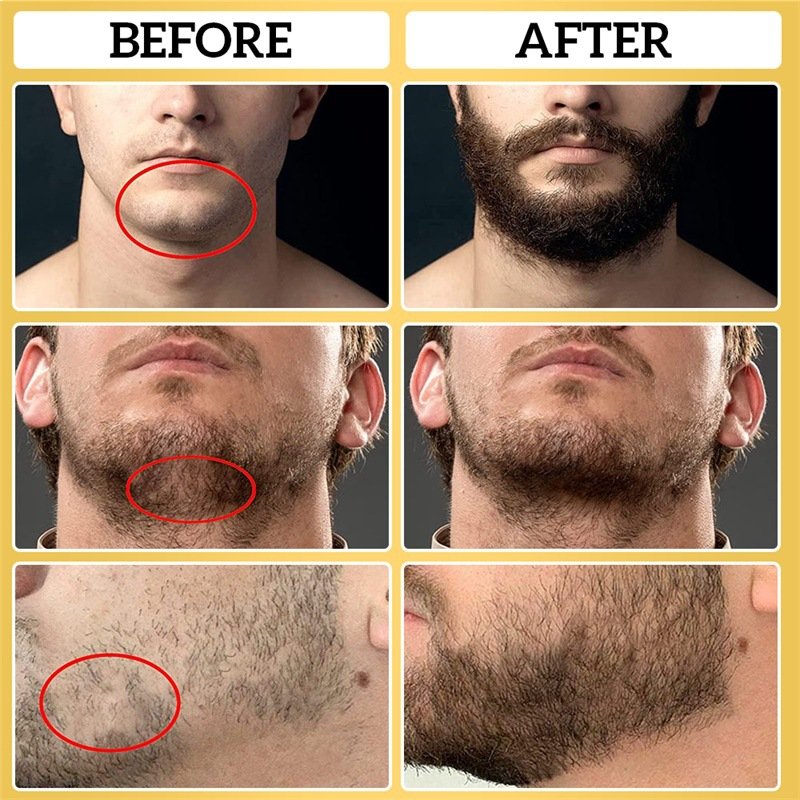 SKIH Private Label Professional Natural Organic Beard Growth Oil Beard Care With Beard Wash And Conditioner