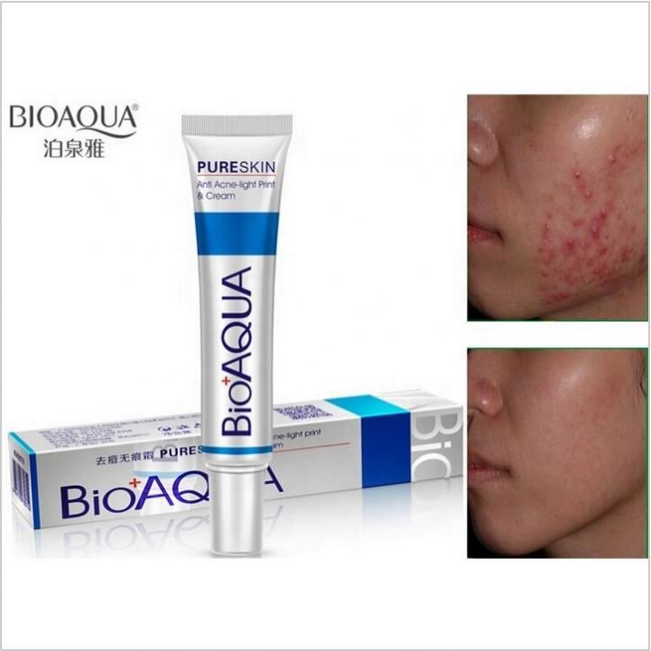BIOAQUA Moisturizing Face Cream Skin Care Acne Treatment Cream