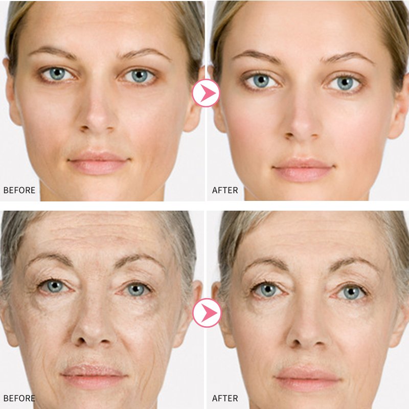 SheDiary Rose Face Skin Lightening Dark Spot Cream Natural Brightening Nicotinamide Skin Whitening Facial Care Cream