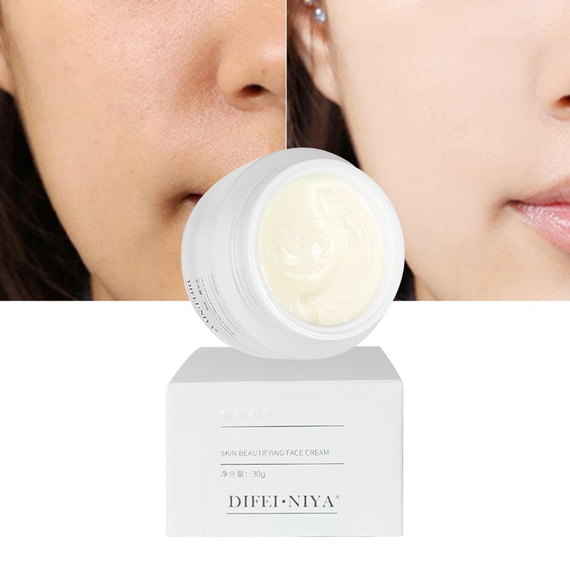 Factory Wholesale Native Whitening Face Freckle Cream Dark Spot Skin Care Freckle Remover Cream