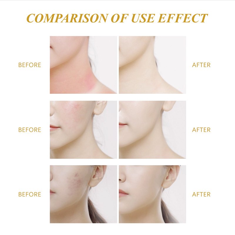 Beauty Facial Anti 24k Acne Aging Face Skin Care Set Organic Women Private Label Whitening gold Skincare Set