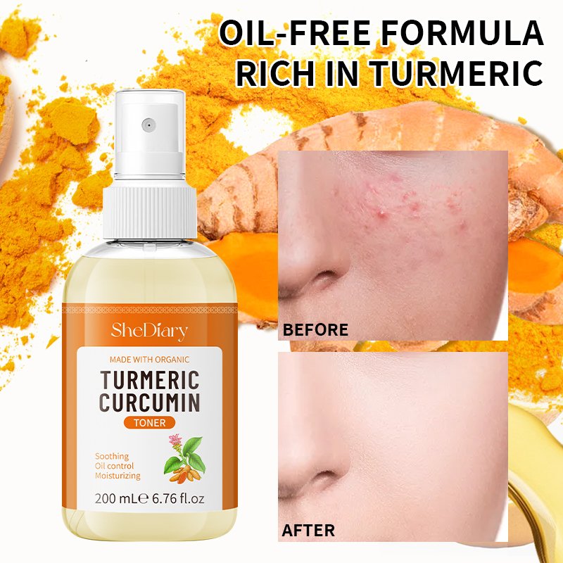 SheDiary Private Plant Formula Strong Lightening Facial Toner Moisturizing Whitening Brightening Acne Treatment Face Toner