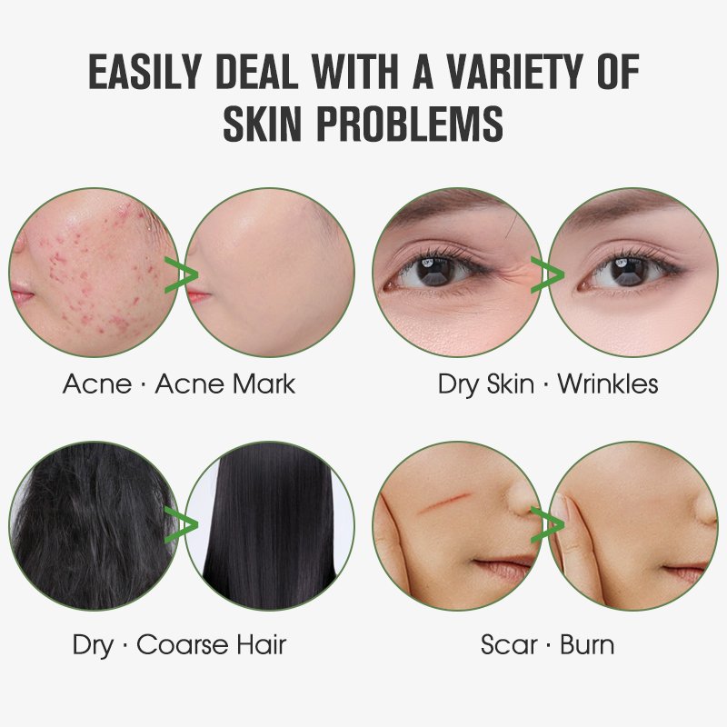Smoothing Gel Aloe Vera Cruelty-free Moisturizing & Nourishing and Hyaluronic acid & Organic Vegan Aloe Vera Gel Skin