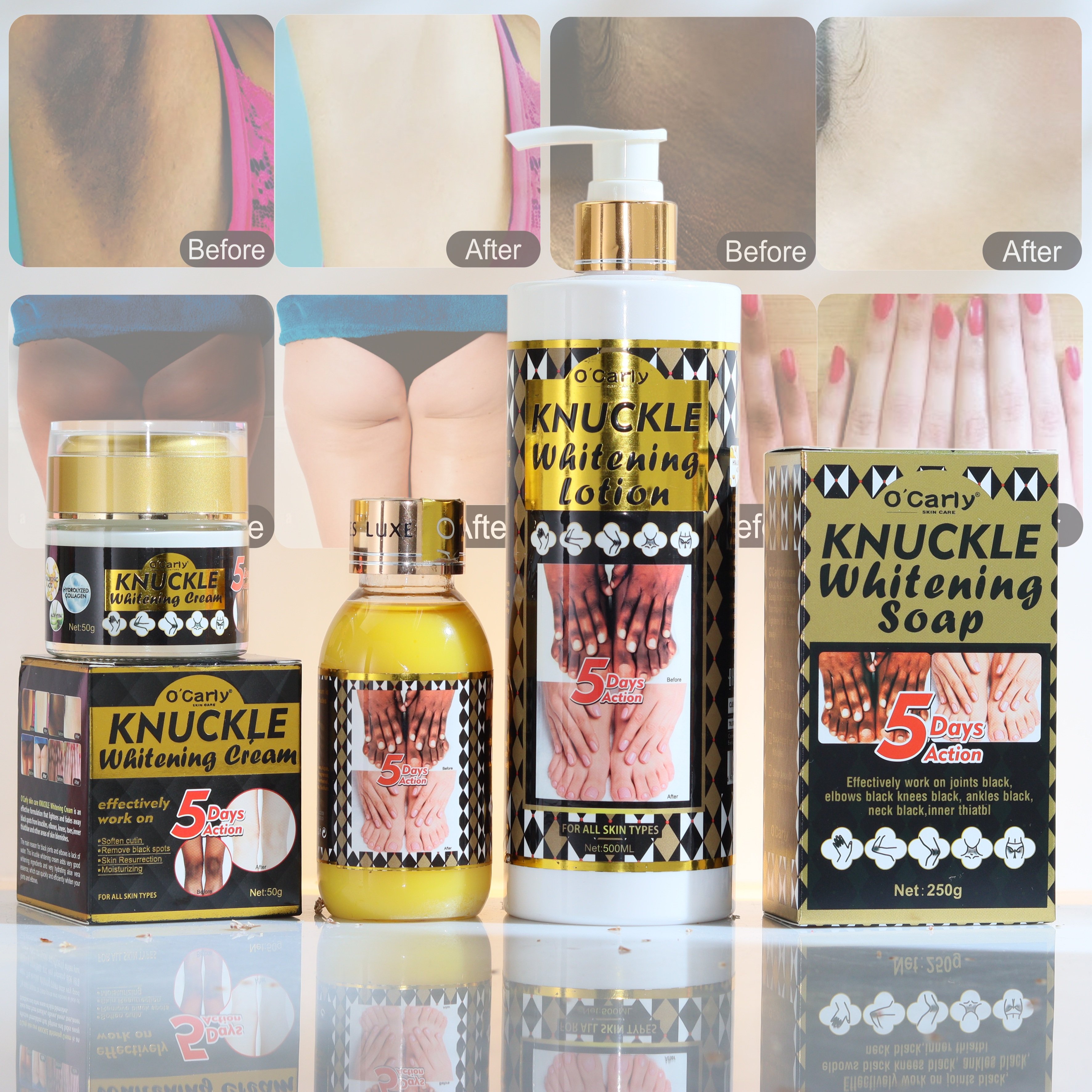 Private Label O'Carly Knuckle Whitening Set Skin Care Beauty Products Body Lotion Face Serum Soap Cream Cosmetics