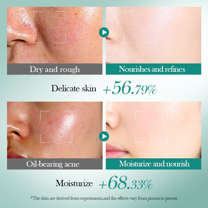 OEM BIOAQUA Private Label Hyaluronic acid Moisturizing Repair Skin Care Gift Set Brightening Firming Facial Skin Care Set