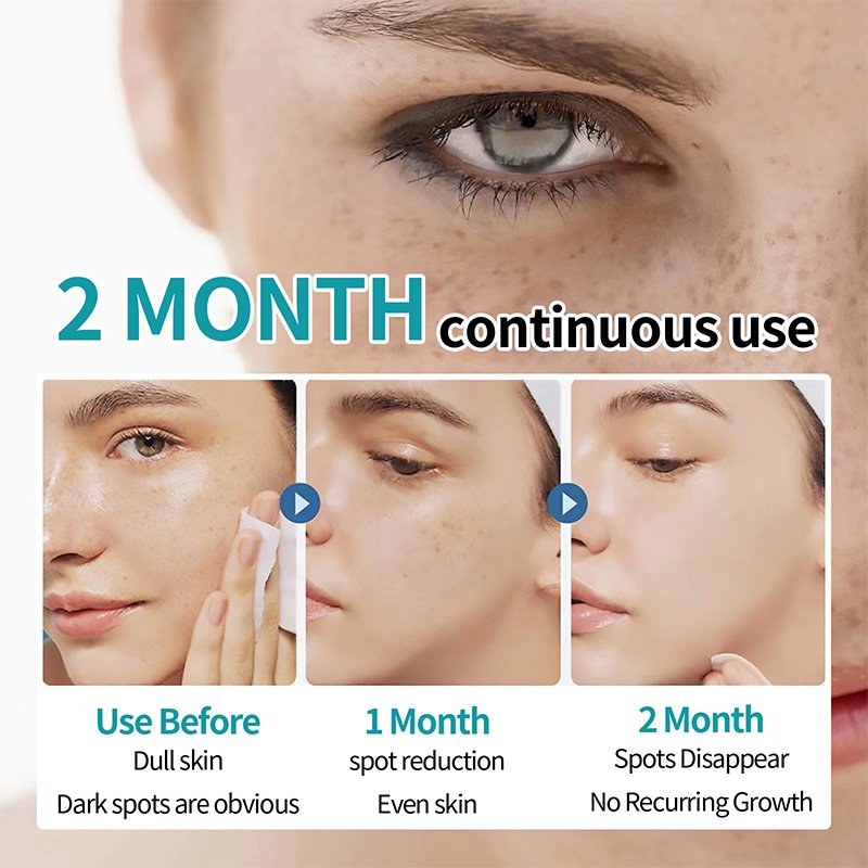 Nicotinamide whitening cream