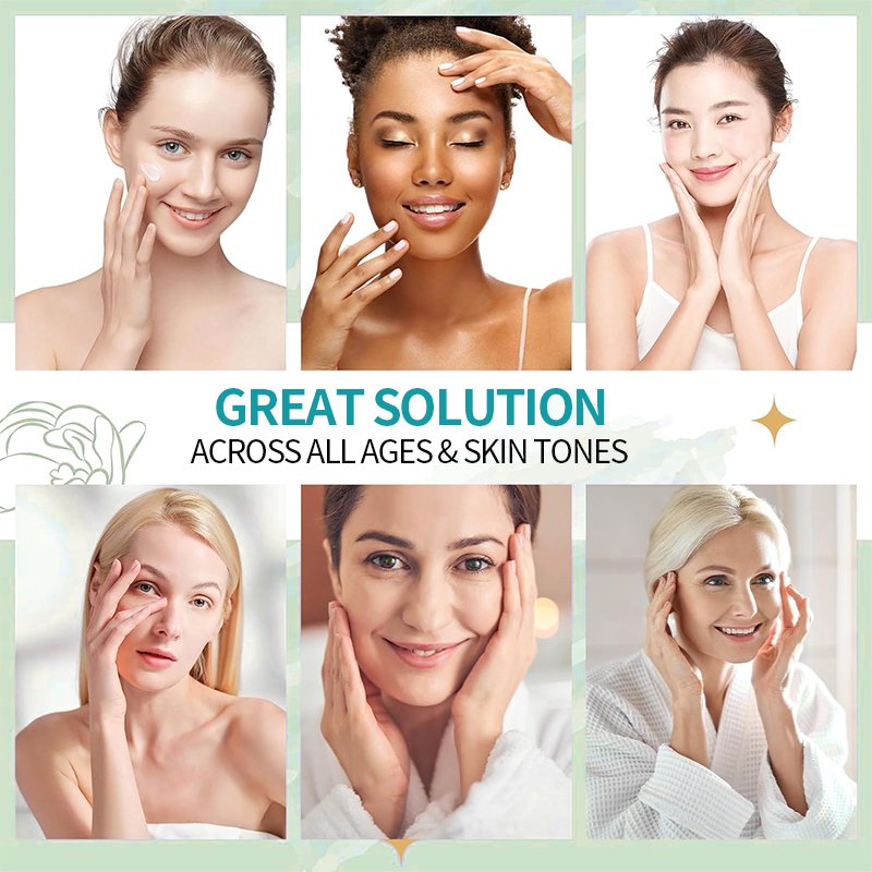 Nicotinamide whitening cream