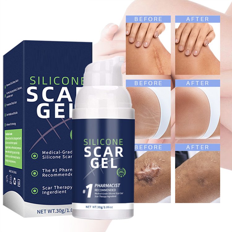 RubioAroma Private Label Hot Sale Natural Anti Vergeture Cream Pregnancy Mango Stretch Mark Cream
