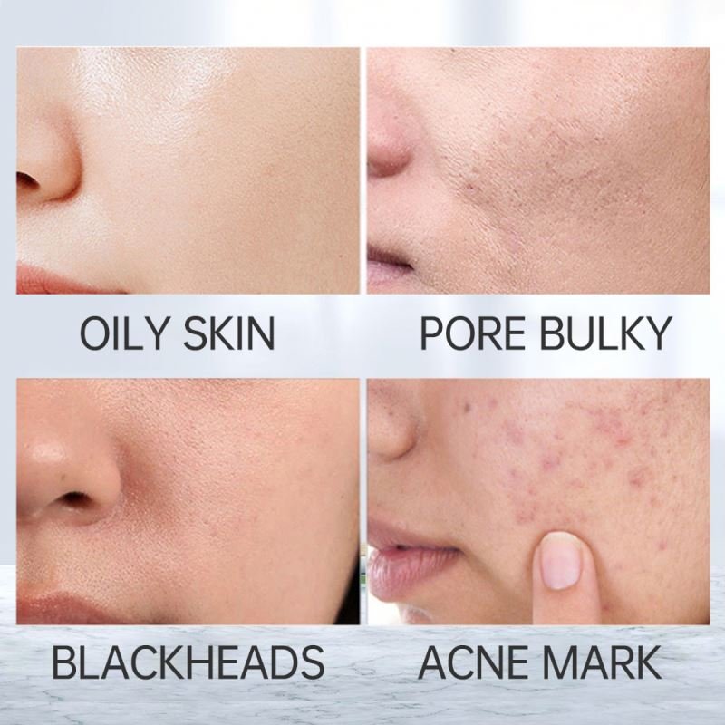 OEM Deep Pore Hydrate Facial Cleanser Bottle Gentle Skin Care Salvia Exfoliator Face Cleanser Private Label Mousse Face Wash