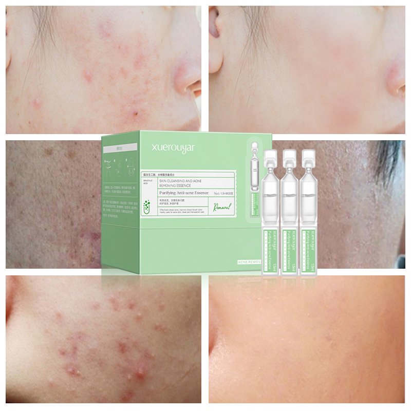 Factory-Created OEM/ODM Customizable Anti-Aging Anti-Wrinkle Beauty Organic Ingredients Liquid Form Face Ampoule Serum