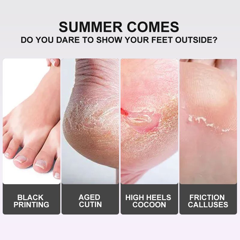 Wholesale OEM APPTI Lavender Exfoliating Foot Peel Mask Removal Calluses Crack Heel Sock For Pedicure Feet Spa