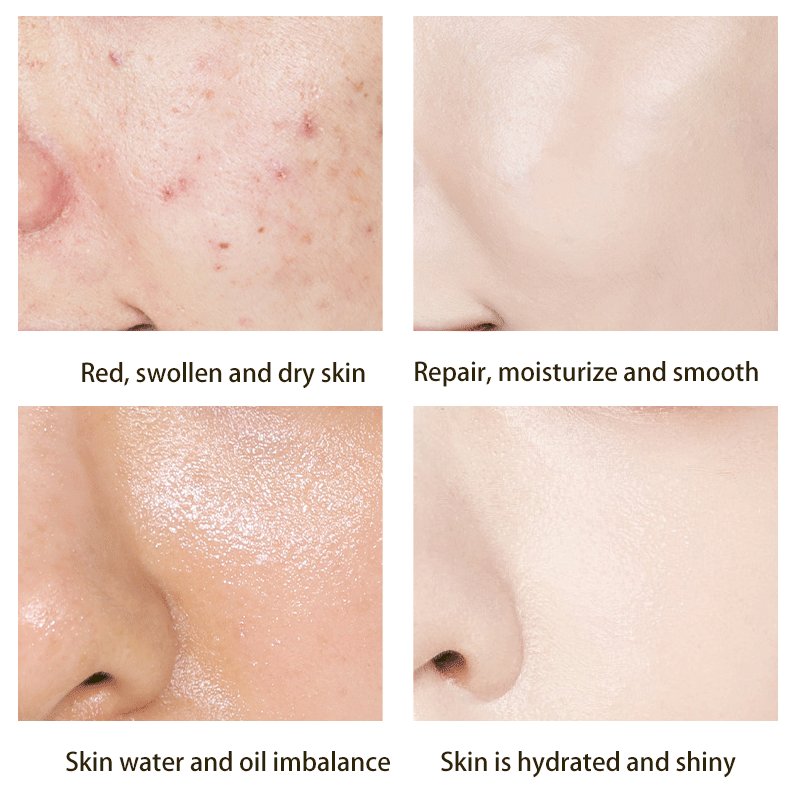 Facial Anti-aging Serum Moisturizing Hydrating Hyaluronic Acid Serum Whitening Facial Ampoule Serum