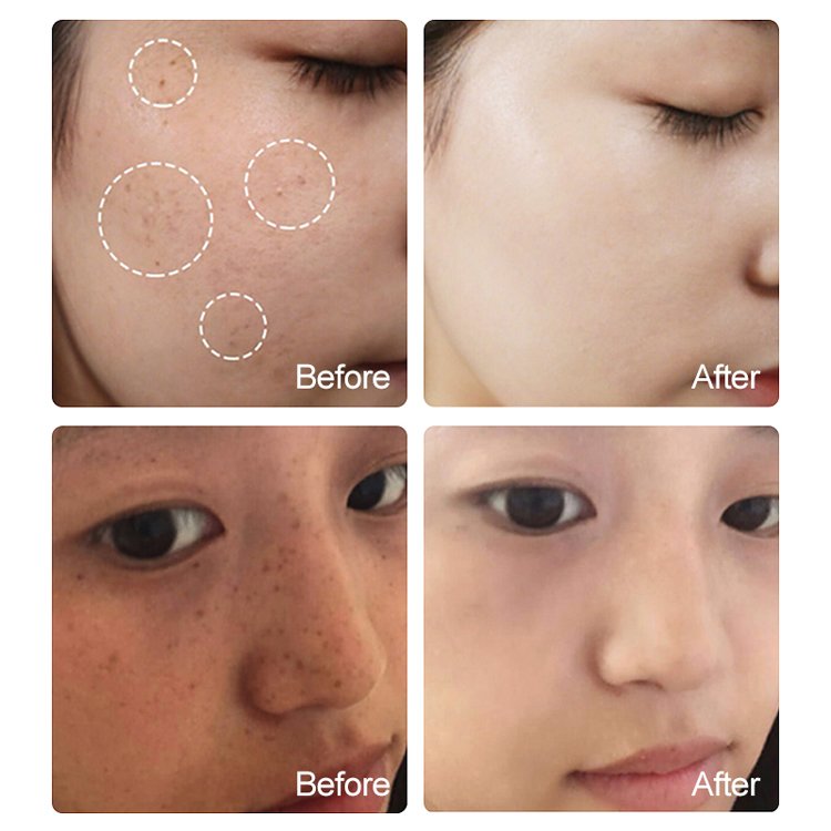 Factory Sale Korean Organic Firming Collagen Face Remove Wrinkles Anti-Aging Hydrating Whitening Skin Care Facial Serum