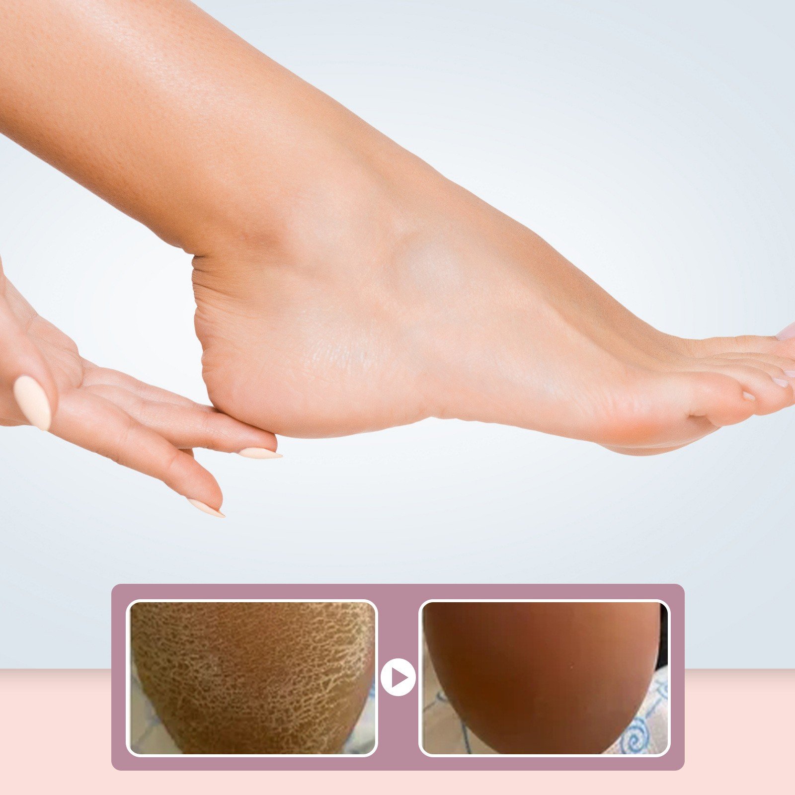 Best Selling Smooth Improve Rough Skin Cracked Heels Moisturizing High Quality Hydration Foot Cream