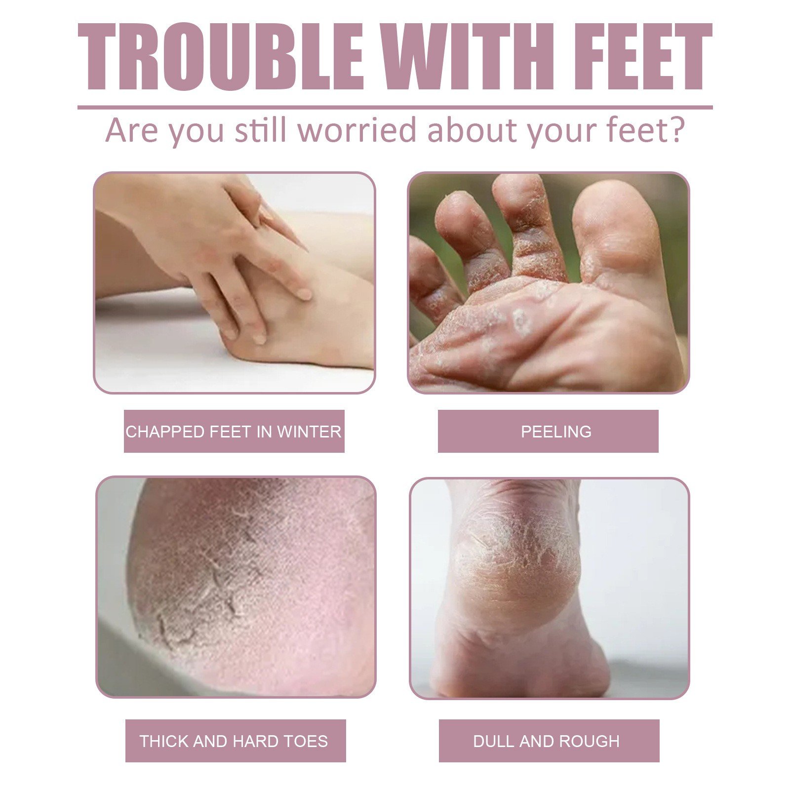 Best Selling Smooth Improve Rough Skin Cracked Heels Moisturizing High Quality Hydration Foot Cream
