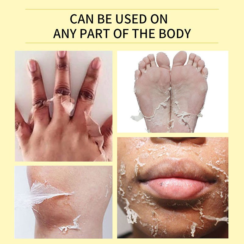 New arrival 3 days strong salicylic acid whitening body chemical peeling oil for face