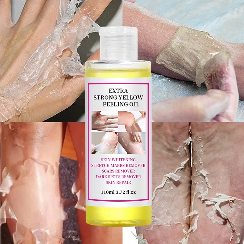New arrival 3 days strong salicylic acid whitening body chemical peeling oil for face
